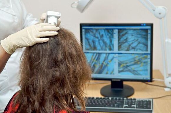 Przeprowadzanie trichoskopii diagnostycznej